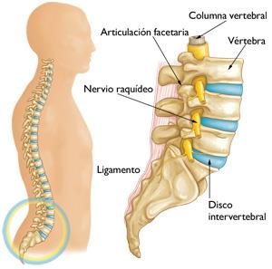 pulmón Larva del moscardón invernadero Dolor de espalda inferior - Dr Eliseo Mora Sanchez